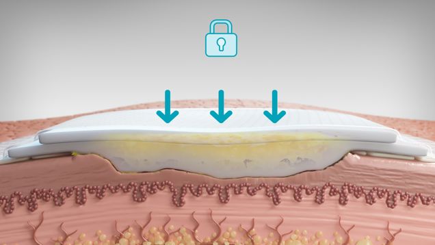 Graphic of Biatain Silicone Fit retaining and locking away exudate.