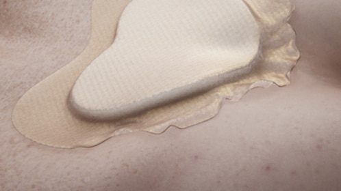 Foam dressing exhibiting border rolling.