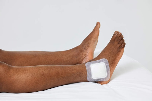Biatain Silicone Fit 4 x 4” dressing applied to ankle. 