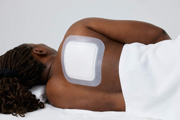 Biatain Silicone Fit 7 x 7” dressing applied to shoulder. 