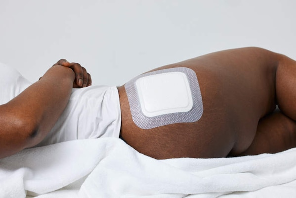 Biatain Silicone Fit 6 x 6” dressing applied to hip.