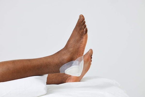 Biatain Silicone Fit heel dressing applied to heel.
