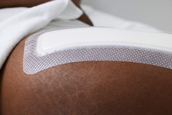 Biatain Silicone Fit 4 x 12” dressing applied to hip.
