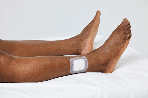 Biatain Silicone Fit 3 x 3 dressing applied to ankle.