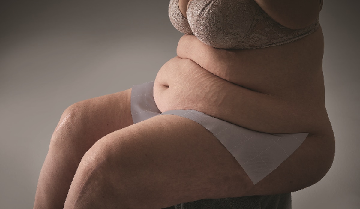 InterDry® vs. traditional therapies