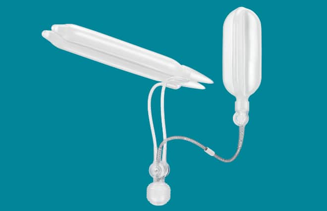 Inflatable Ipp Step-by-Step Titan IPP: Infrapubic Surgical Technique