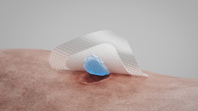 Discover our silicone foam dressing