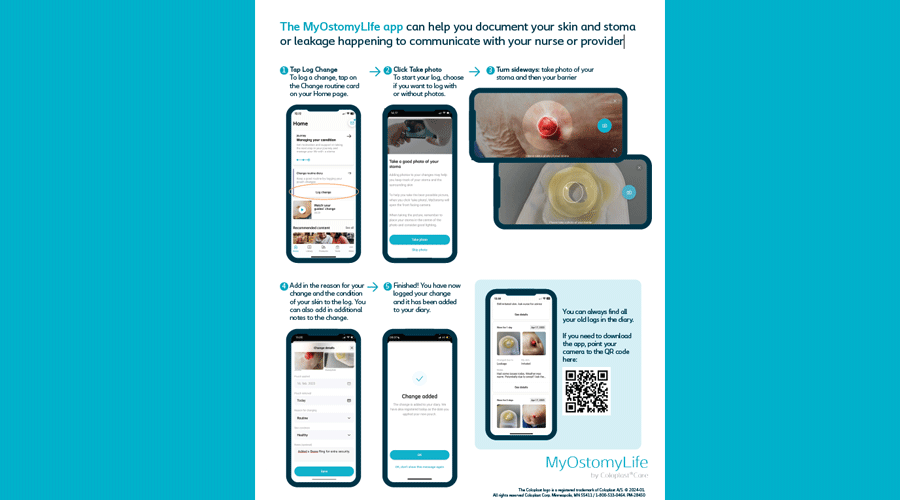 Supporting better outcomes with the MyOstomyLife app