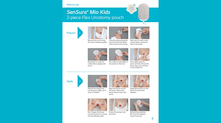 SenSura® Mio Kids 2-Piece Flex Urostomy Pouch Pictorial Guide