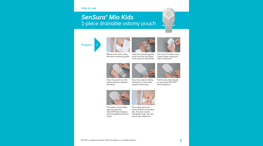 SenSura® Mio Kids – 1-Piece Drainable Pouch Pictorial Guide