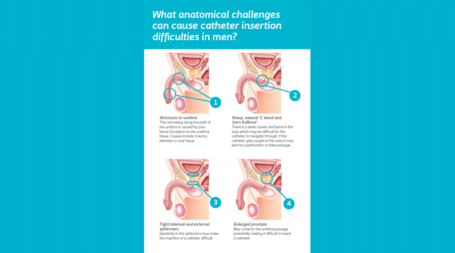 Anatomical challenges in men